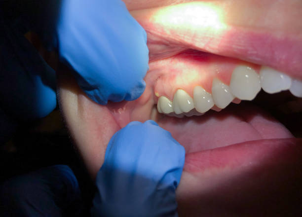 Best Broken Tooth Emergency  in Guilford Center, CT