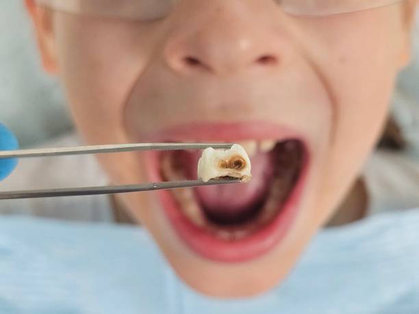 Best Tooth Infection Emergency Dentist  in Guilford Center, CT